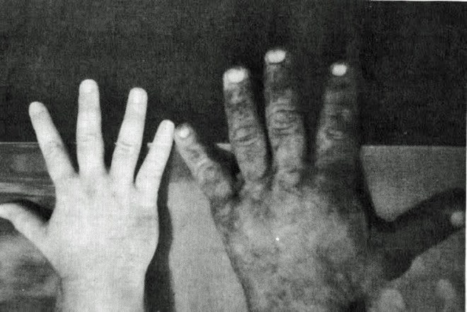 handshandnextterrytodd